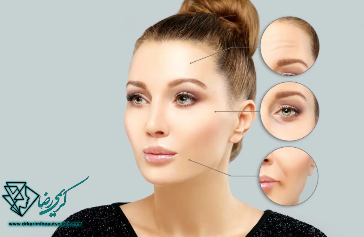 عوارض احتمالی بوتاکس فول فیس