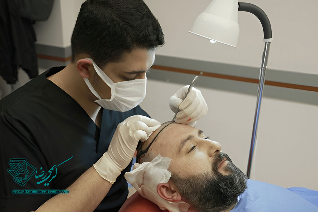 کلینیک تخصصی کاشت مو در زعفرانیه