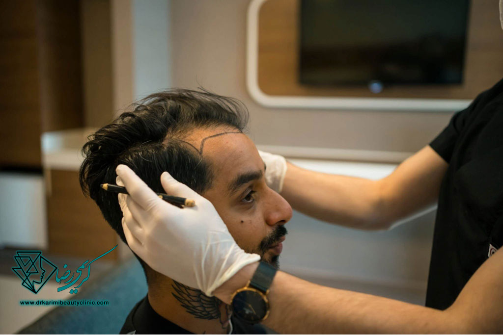 کلینیک تخصصی کاشت مو