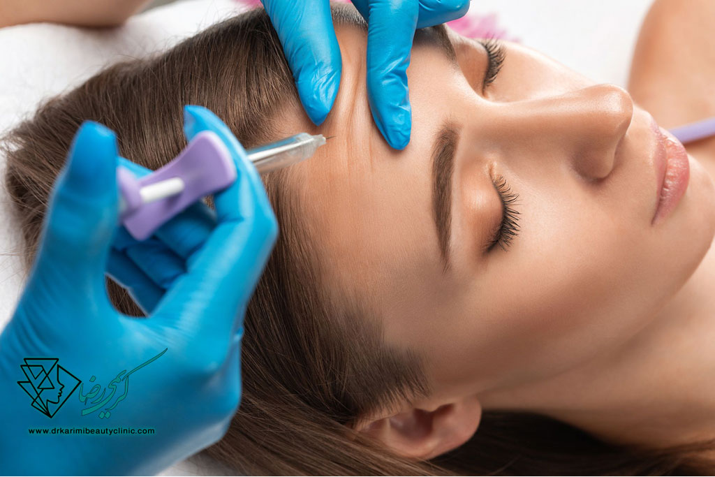 چگونه بوتاکس باعث پیشگیری از چروک‌های آینده می‌شود؟