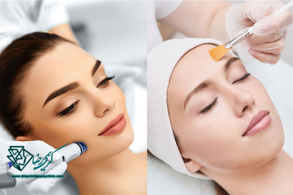 تفاوت بین لایه‌برداری شیمیایی، میکرودرم و پیلینگ طبیعی