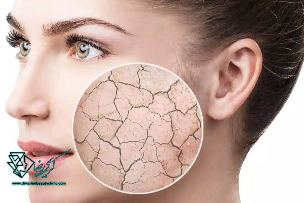 بهترین روتین پوستی