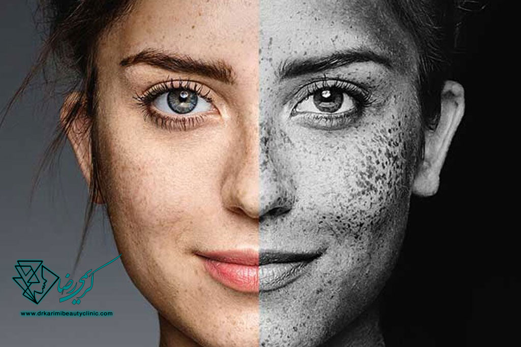 تأثیر آلودگی هوا بر پوست و راه‌های محافظت از آن