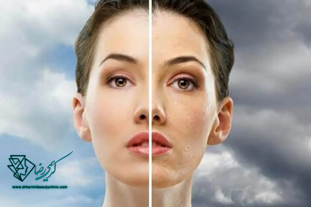 تأثیر آلودگی هوا بر پوست