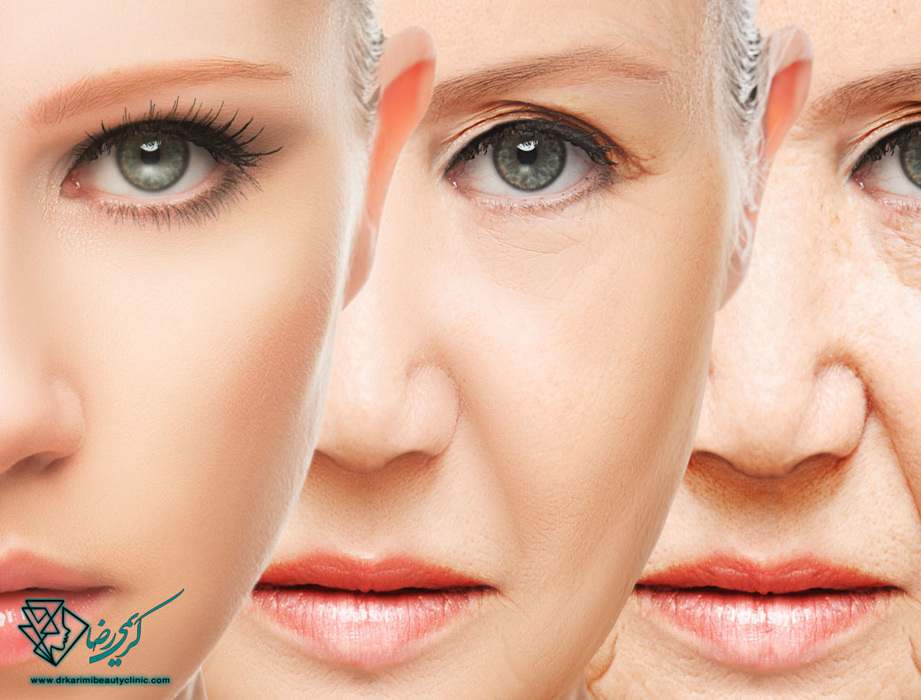بوتاکس پیشگیری شمال تهران